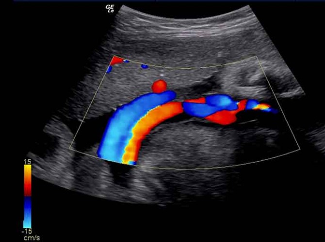 ecografia doppler zootec
